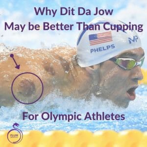 What is Cupping? and Why Trauma Liniments May be Better than Cupping for Athletes