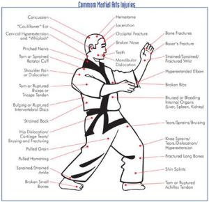 Using Chinese Martial Arts Herbal Trauma Formulas (Part 1)